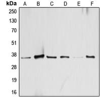ATF1 Antibody (C-Terminus)