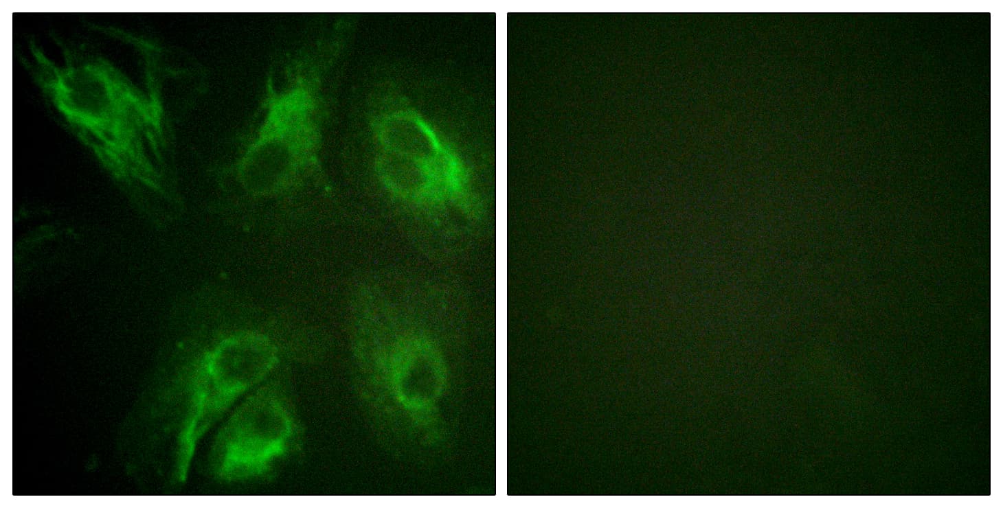KCNIP3 / Dream / Calsenilin Antibody (phospho-Ser63)
