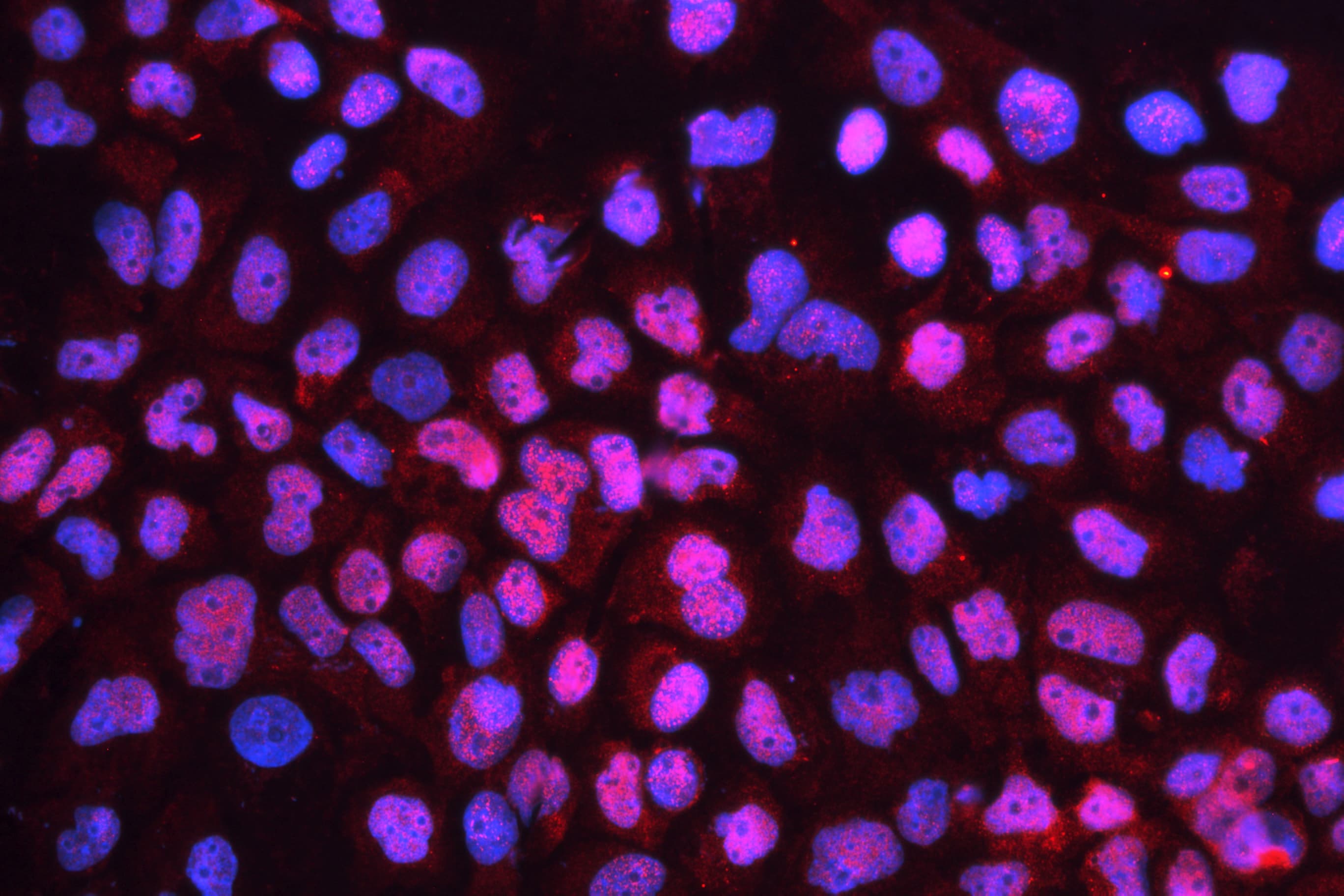 CD79B / CD79 Beta Antibody (aa29-229)