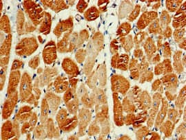 Polyclonal Rabbit anti-Human PIK3C3 / VPS34 Antibody (IHC, WB)