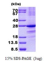 Human SSX1 Protein (Recombinant His)