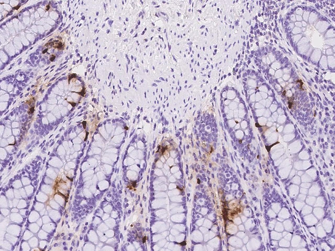Polyclonal Rabbit anti-Human INSL5 Antibody (IHC)