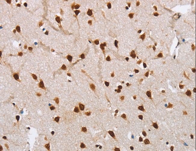 Polyclonal Rabbit anti-Human NLRP7 / NALP7 Antibody (IHC)