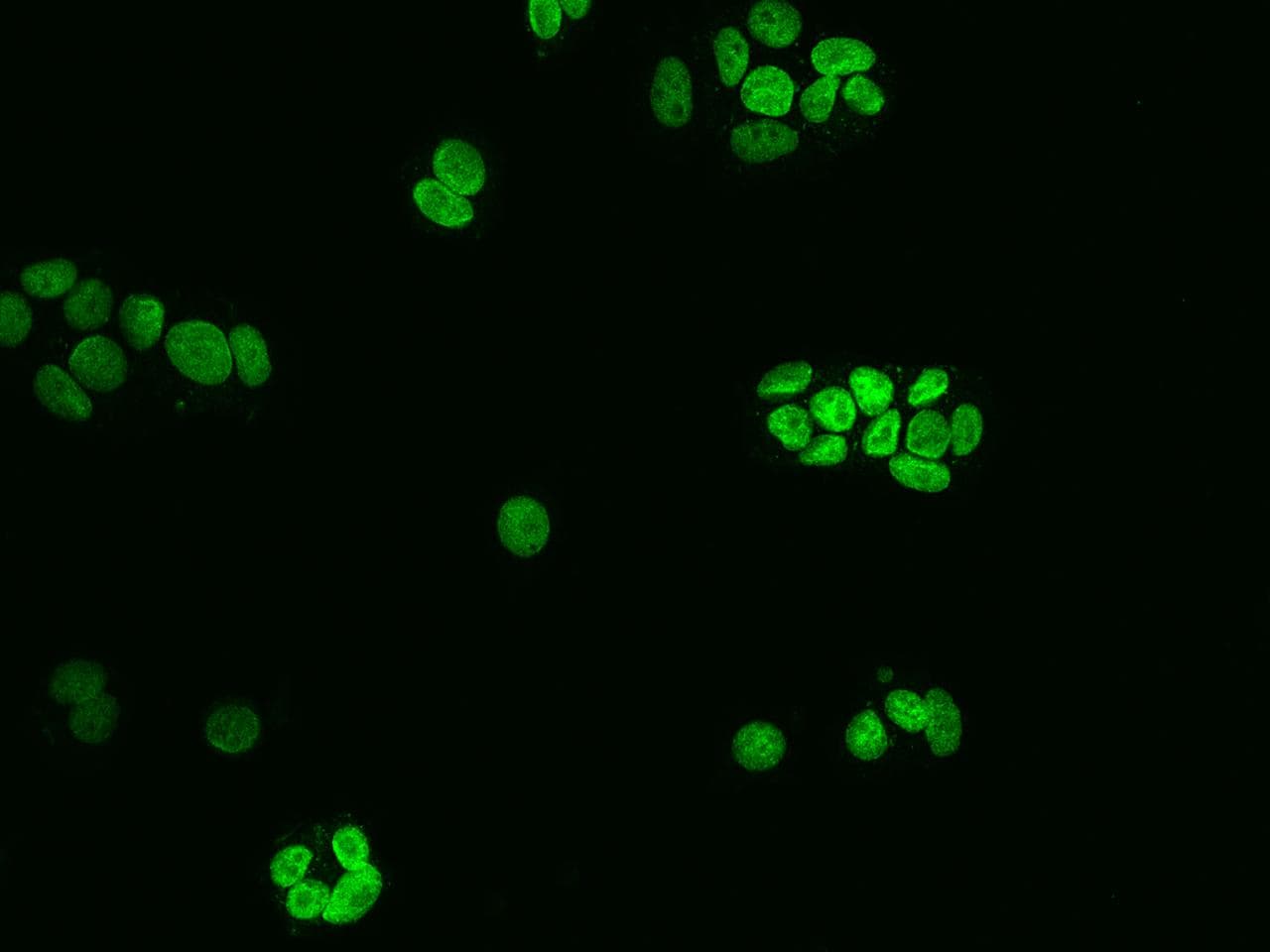 NUP50 Antibody