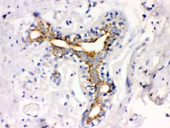 ATXN2 / SCA2 / Ataxin-2 Antibody
