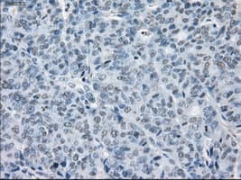 SLC7A8 / LAT2 Antibody (clone OTI7D6)
