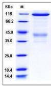 Mouse c-Met Protein (Recombinant Human IgG Fc, C-terminus)