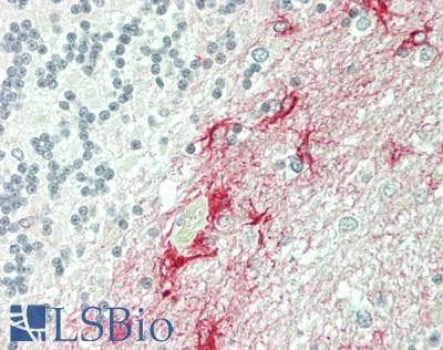 IHC-plus™ Monoclonal Mouse anti-Human GFAP Antibody (clone S206A-8, aa411-422, IHC, WB)