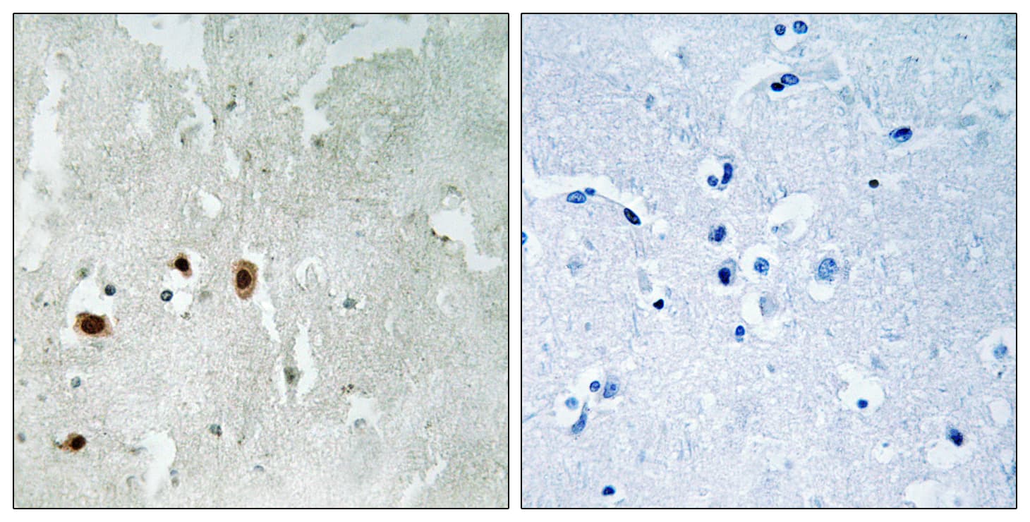 KAT5 / TIP60 Antibody (phospho-Ser90)