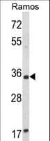 ACY3 Antibody (aa66-95)