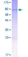 Human KIAA0776 / NLBP Protein (Recombinant GST)