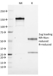 CD19 Antibody (clone CVID3/155)