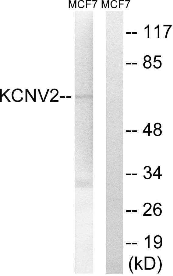 KCNV2 / Kv11.1 Antibody