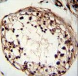 Polyclonal Rabbit anti-Human TSPYL6 Antibody (aa206-235, IHC, IF, WB)