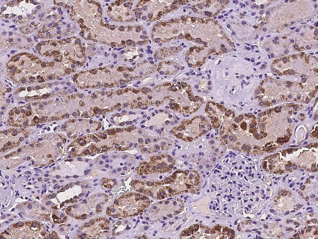 ABAT Antibody