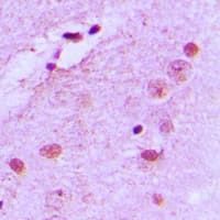 NPM1 / NPM / Nucleophosmin Antibody (phospho-Thr199)