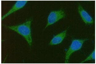 Monoclonal Mouse anti-Human TBCEL / E-Like Antibody (clone AT1B10, WB)
