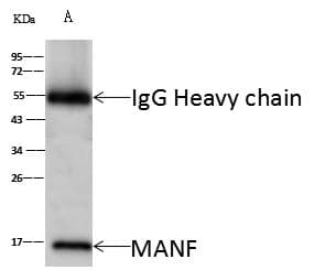 Polyclonal Rabbit anti-Human MANF / ARMET Antibody (Preservative Free, WB)