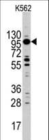 MYO1C Antibody (aa911-940)