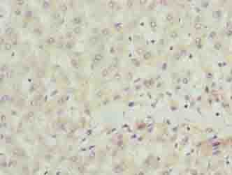 SCLT1 Antibody