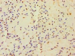 HAUS3 / C4orf15 Antibody (aa384-603)