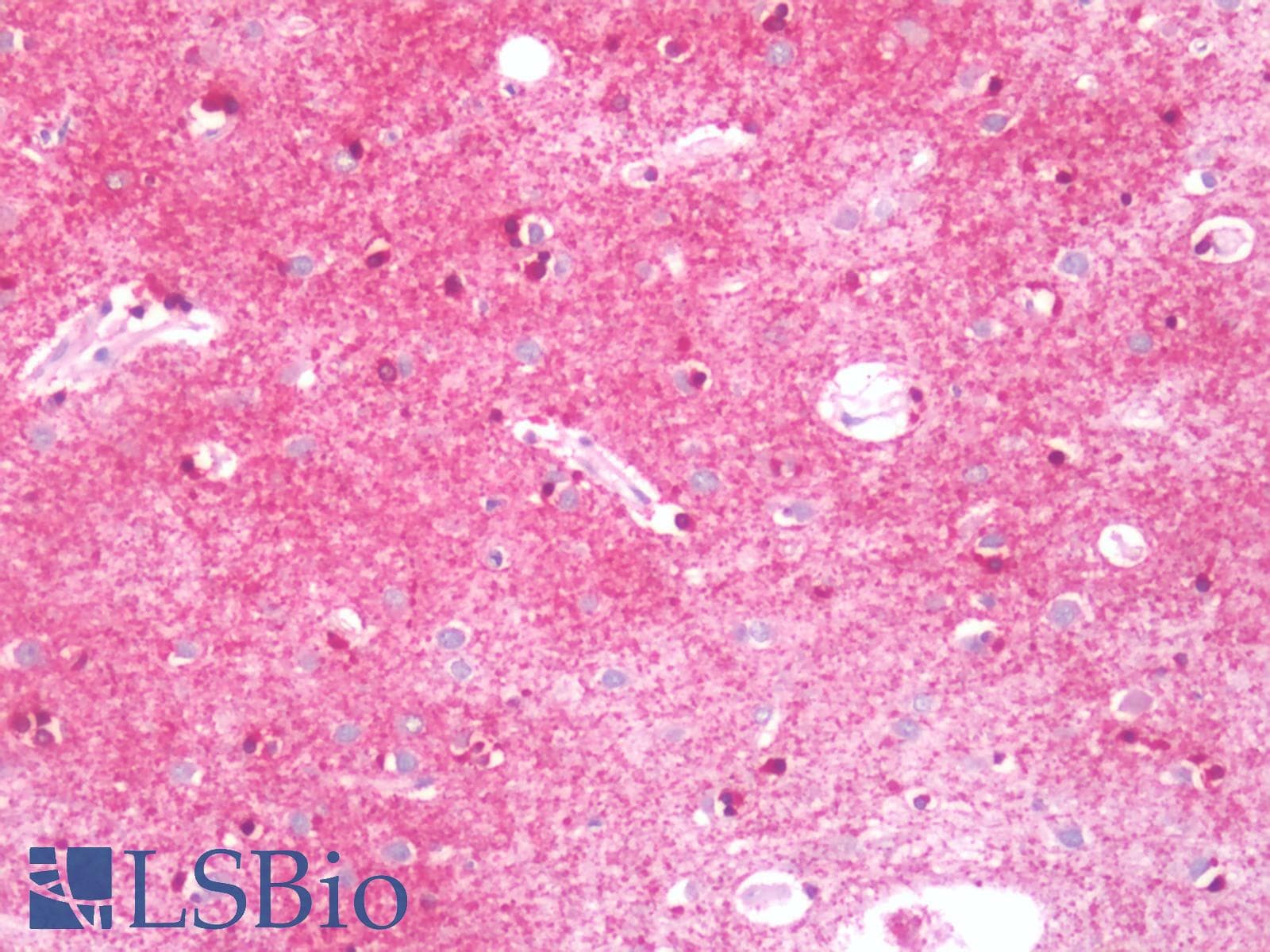 IHC-plus™ KCNMB4 Antibody (aa86-140)