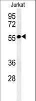 STK33 Antibody (aa476-506)