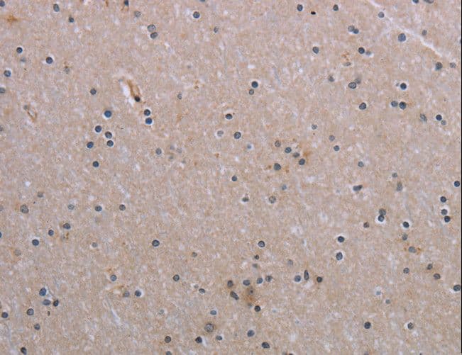 Polyclonal Rabbit anti-Human BIRC1 / NAIP Antibody (IHC)