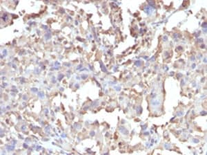 TNF Alpha Antibody (clone RMTNFA-1)