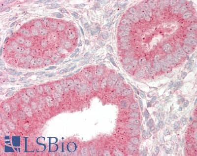 PathPlus™ RAB5A / RAB5 Antibody