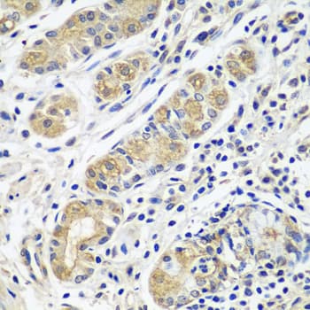 GPRC5A / RAI3 Antibody