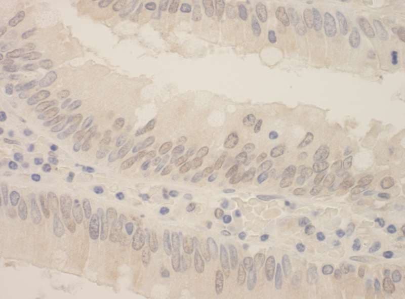 Polyclonal Rabbit anti-Human SRPK2 Antibody (aa425-475, IHC, IF)