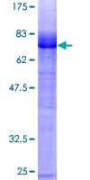 Human EGLN2 / PHD1 Protein (Recombinant GST)