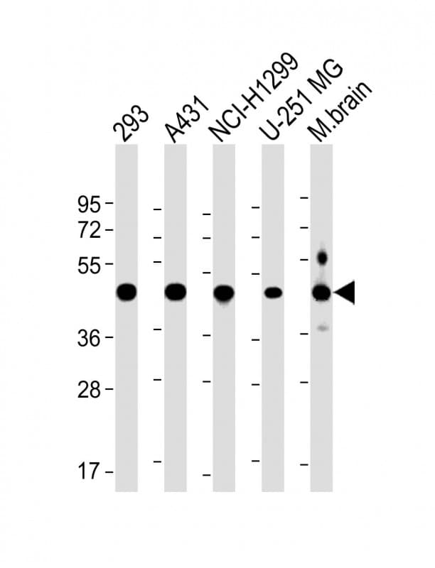 NSFL1C Antibody (Internal)