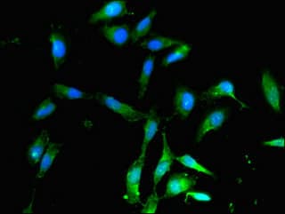 ALDH9A1 Antibody