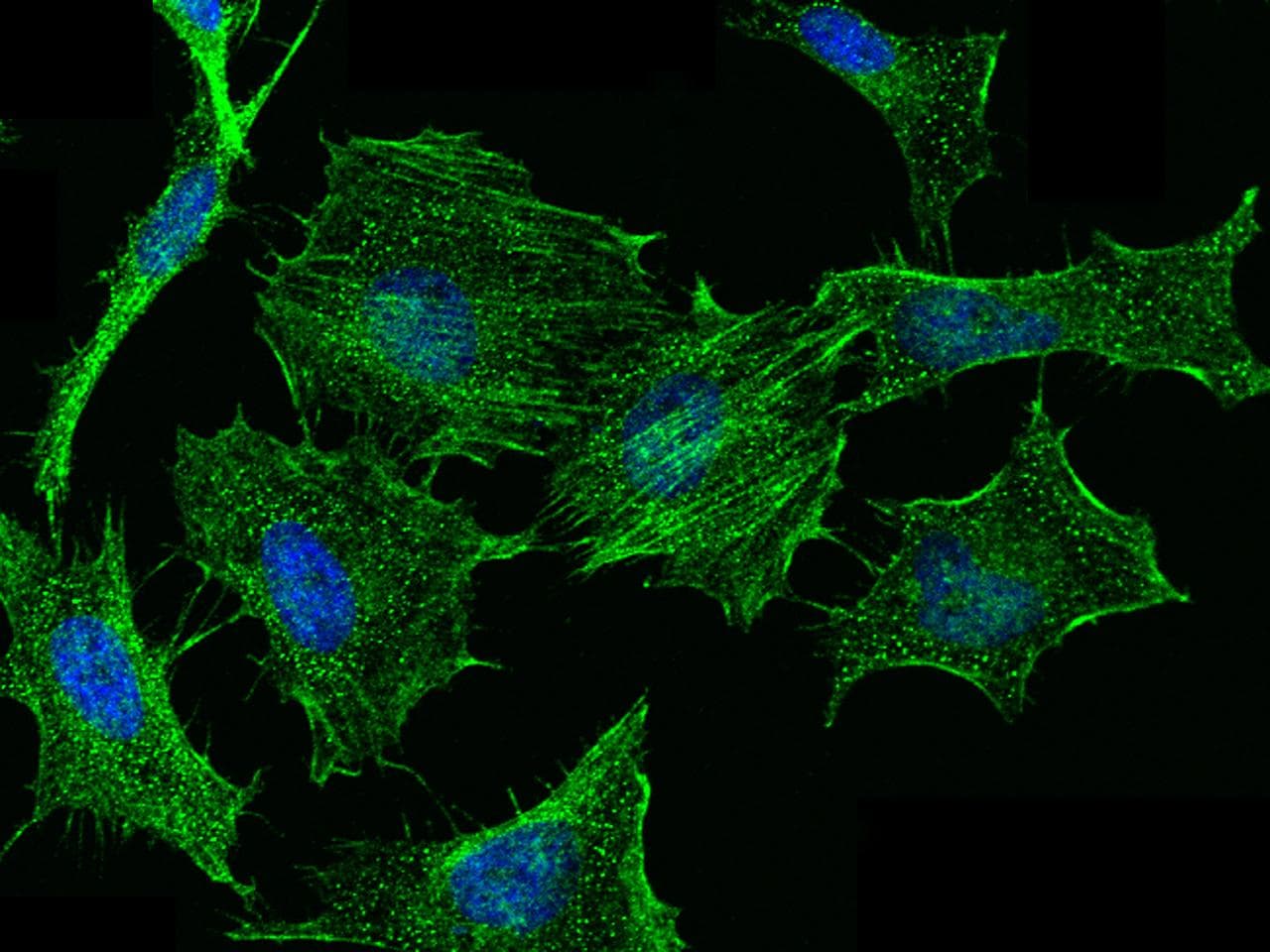 CALD1 / Caldesmon Antibody (Preservative Free)