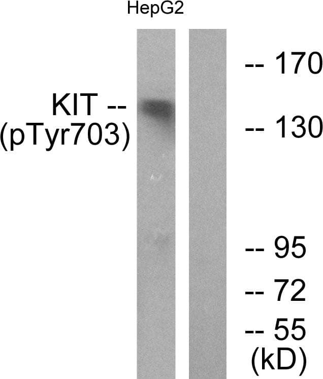 Polyclonal Rabbit anti-Human c-Kit / CD117 Antibody (phospho-Tyr703, IHC, WB)