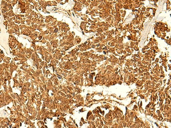 Polyclonal Rabbit anti-Human ABHD10 Antibody (IHC)