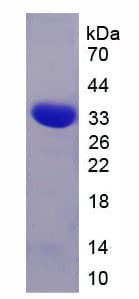 Human CNTFR Protein (Recombinant His-T7)