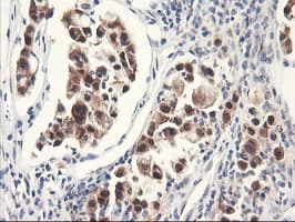 FBXO21 Antibody (clone OTI1E1)