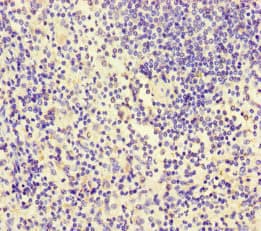 ITGA4 / VLA-4 / CD49d Antibody