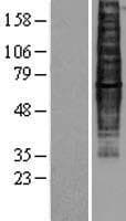 CCR9 / CD199 Protein (Over-Expression Lysate Myc-DDK (Flag))