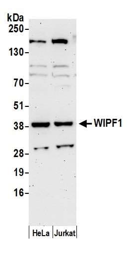 WIPF1 / WIP Antibody (aa150-200)