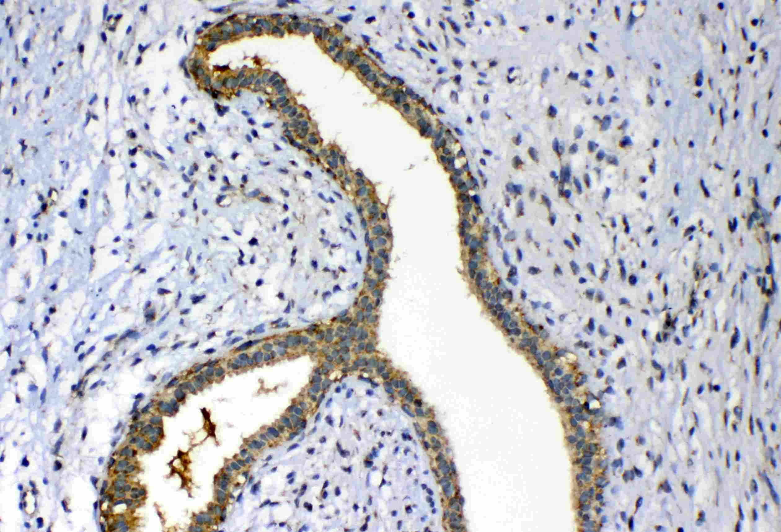 Polyclonal Rabbit anti-Human FH / Fumarase / MCL Antibody (IHC, WB)