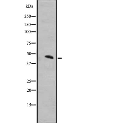 Polyclonal Rabbit anti-Human MCHR1 Antibody (WB)