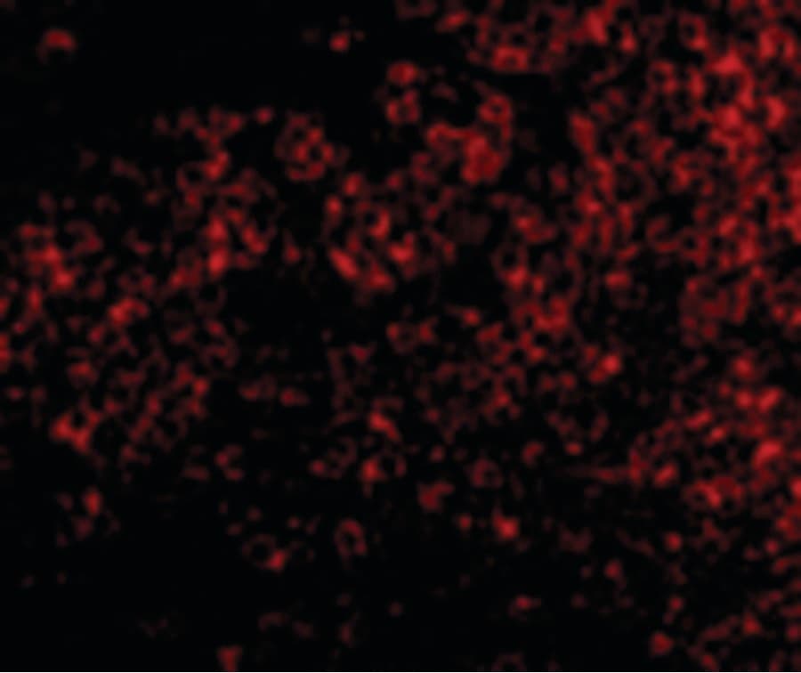 IHC-plus™ Polyclonal Rabbit anti-Human TNFRSF14 / CD270 / HVEM Antibody (IHC, IF, WB)