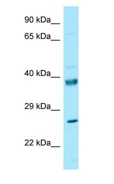 RPL10 / Ribosomal Protein L10 Antibody (N-Terminus)
