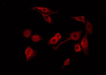 ACHE / Acetylcholinesterase Antibody