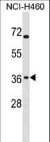 ST6GALNAC4 Antibody (aa181-209)