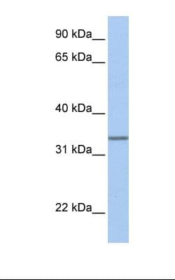 PDEF / SPDEF Antibody (aa182-231, HRP)